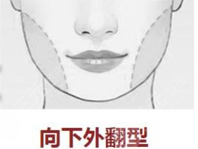 下頜角