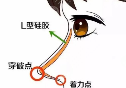 面部整形手術(shù)包括哪些？