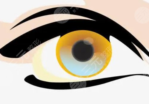 腫眼泡做雙眼皮埋線好還是割好？