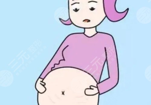 腹部拉皮手術(shù)有疤痕嗎