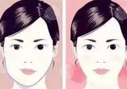 臉型歪了不對稱怎么整
