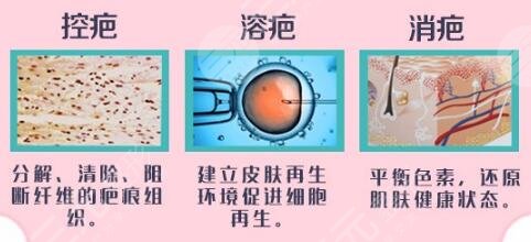 疤痕