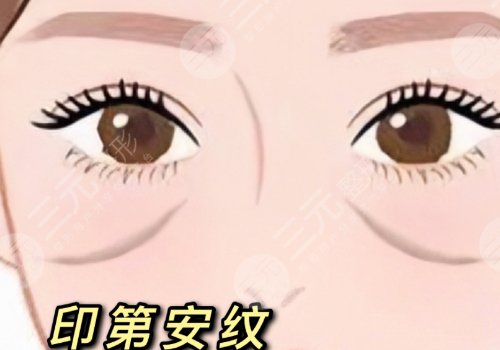 印第安紋和淚溝的區(qū)別是什么？