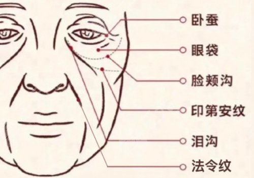 印第安紋和淚溝的區(qū)別是什么？