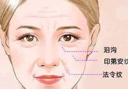 印第安紋和淚溝的區(qū)別是什么？
