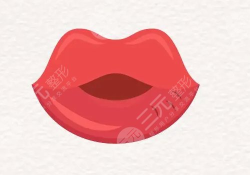 唇部填充用脂肪還是玻尿酸？