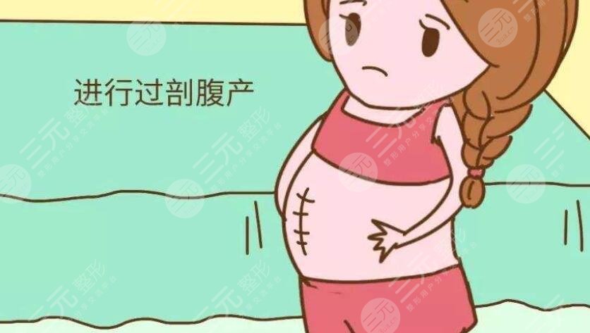剖腹產(chǎn)疤痕