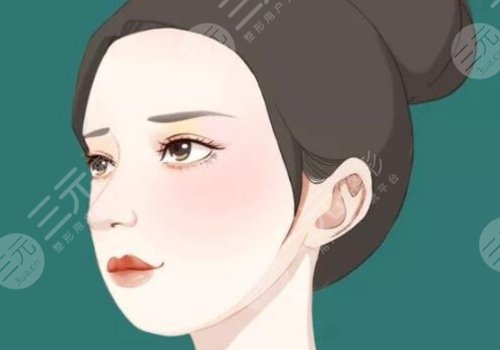 顴骨高有什么辦法改良