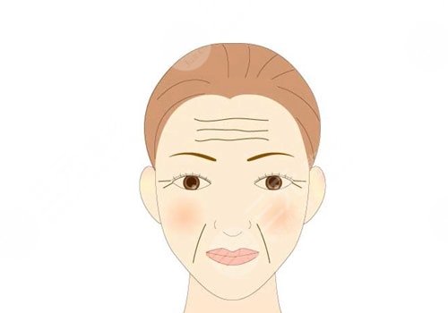 抬頭紋去除手術(shù)需要多少錢？