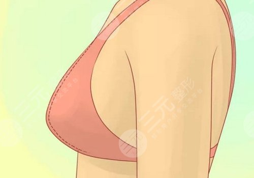 哪種胸型更好看？