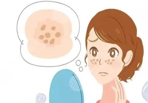臉頰兩側(cè)長(zhǎng)斑是什么原因？