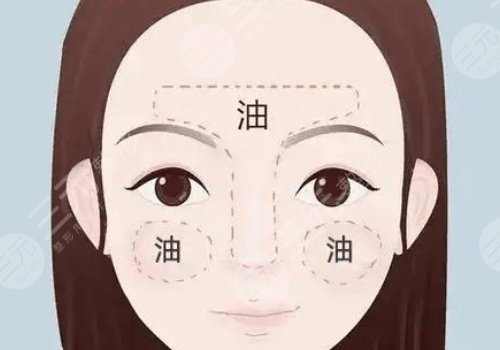t區(qū)出油毛孔粗大怎么辦？