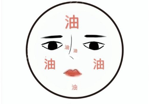 t區(qū)出油毛孔粗大怎么辦？