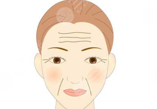 抬頭紋怎么去除？