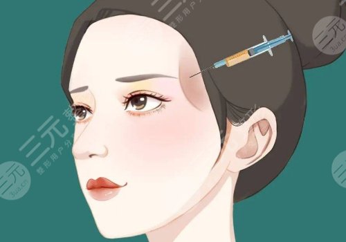 外輪廓提升需要幾支玻尿酸？