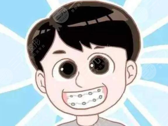 牙齒矯正