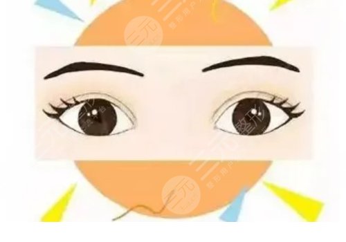 孫培靈醫(yī)生雙眼皮修復(fù)怎么樣？