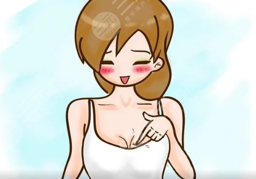 乳房填充能維持多久？