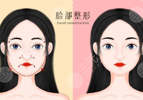 全臉幼態(tài)臉打造大概需要多少費(fèi)用？