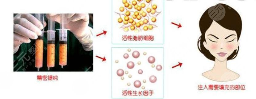 北京大學(xué)人民醫(yī)院整形科擅長項(xiàng)目科普