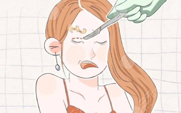雙眼皮