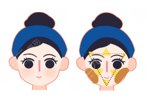 高面部折疊度怎么測