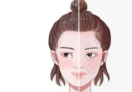 高面部折疊度怎么測？