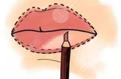 豐唇