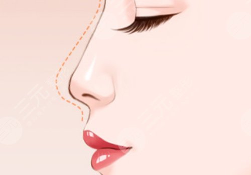 翹鼻和直鼻哪個好看？