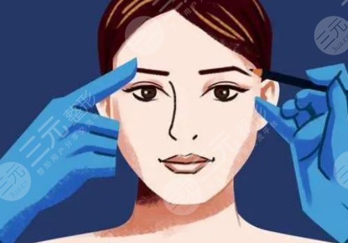 腫眼泡割雙眼皮案例