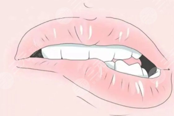 厚唇該薄