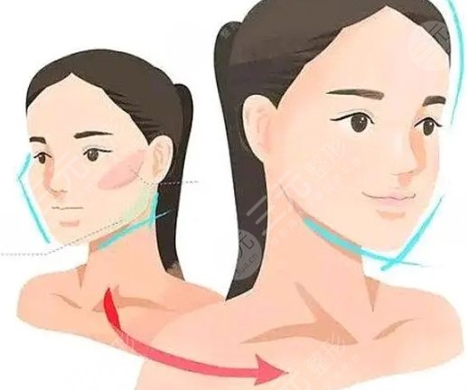 瓜子臉