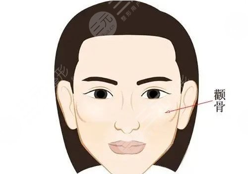 顴骨內(nèi)推加下頜角截骨多少錢