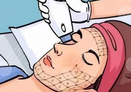 光電抗衰有沒(méi)有副作用