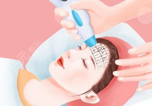 光電抗衰有沒(méi)有副作用？