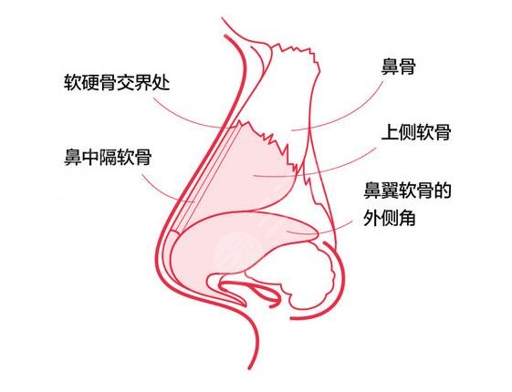 隆鼻維持的時間