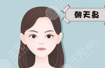 朝天鼻