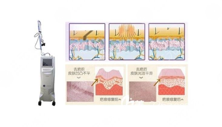 永州中心醫(yī)院美容科擅長(zhǎng)項(xiàng)目科普知識(shí)