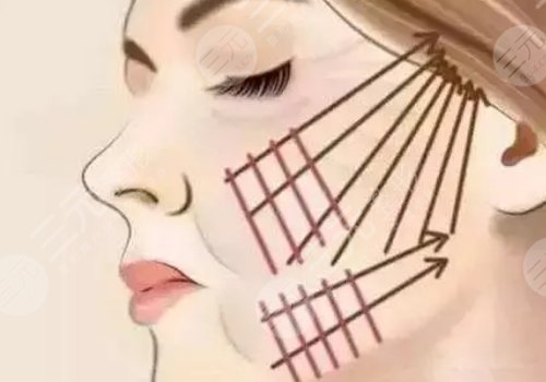 威海拉皮美容要多少錢(qián)