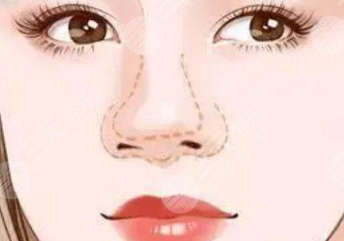 廣州陳伯華做鼻子怎么樣