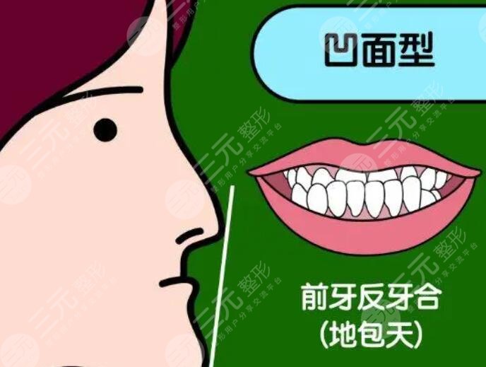 地包天