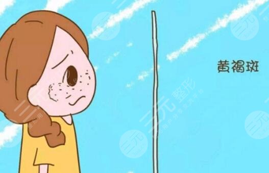 祛斑
