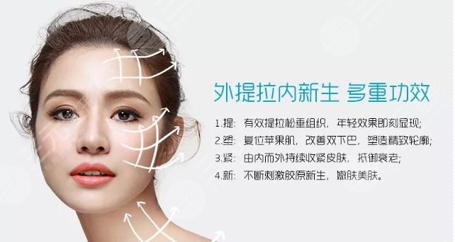 美國強生魚骨線雕能維持多久