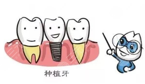 北京大學第三醫(yī)院種植牙案例