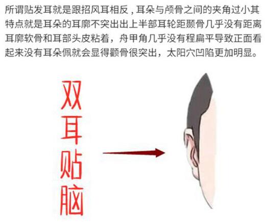 耳基底提升整形怎么做圖片科普！微整輪廓美學(xué)思路，我來教你~