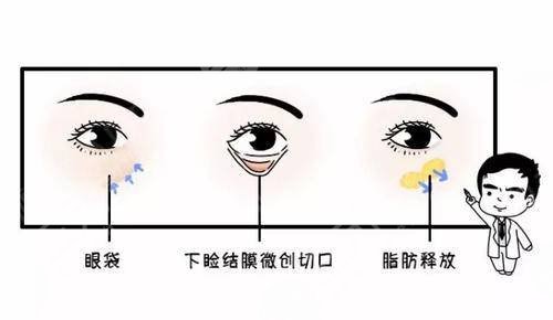 南京去眼袋整形術(shù)的費(fèi)用價(jià)格查詢！3家靠譜醫(yī)院可選~