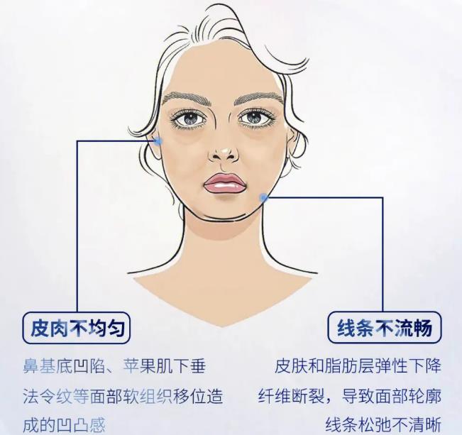 饅化臉怎么做減法？改良方案分享，這2個美學(xué)思路很重要！