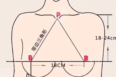 胸型外擴(kuò)0