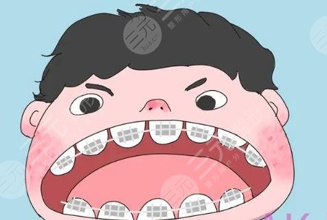 牙齒矯正