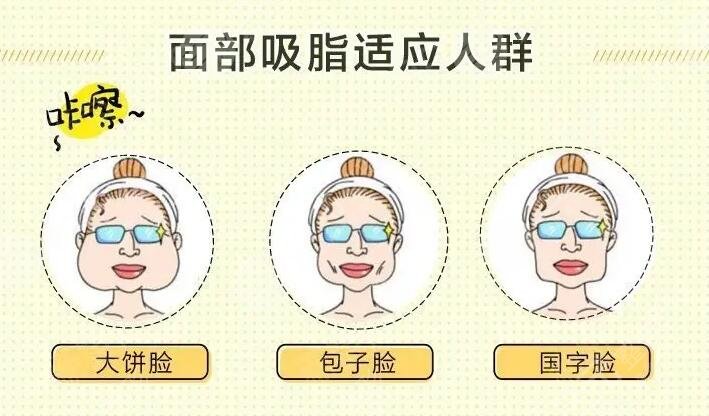 北京潤(rùn)美玉之光面部吸脂案例分享